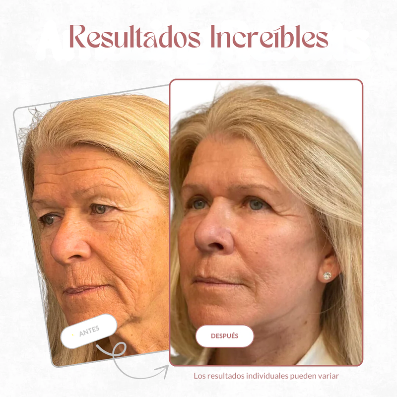 Antes y después