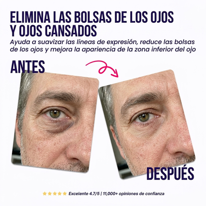 Parches reparadores para el contorno de ojos