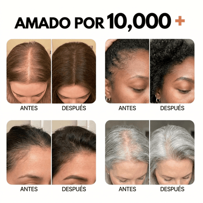 El sérum para el crecimiento del cabello N° 1 de Corea