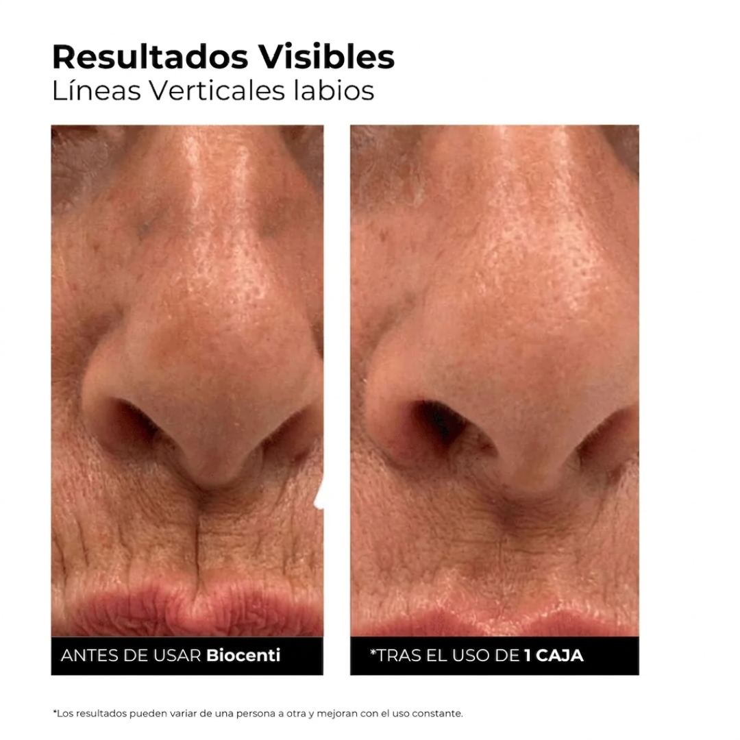 Sérum Ultra Hidratante con 3% de Ácido Hialurónico de Biocenti (30 Ampollas)