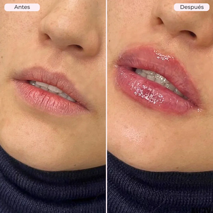 Sérum Voluminizador de Labios de Biocenti