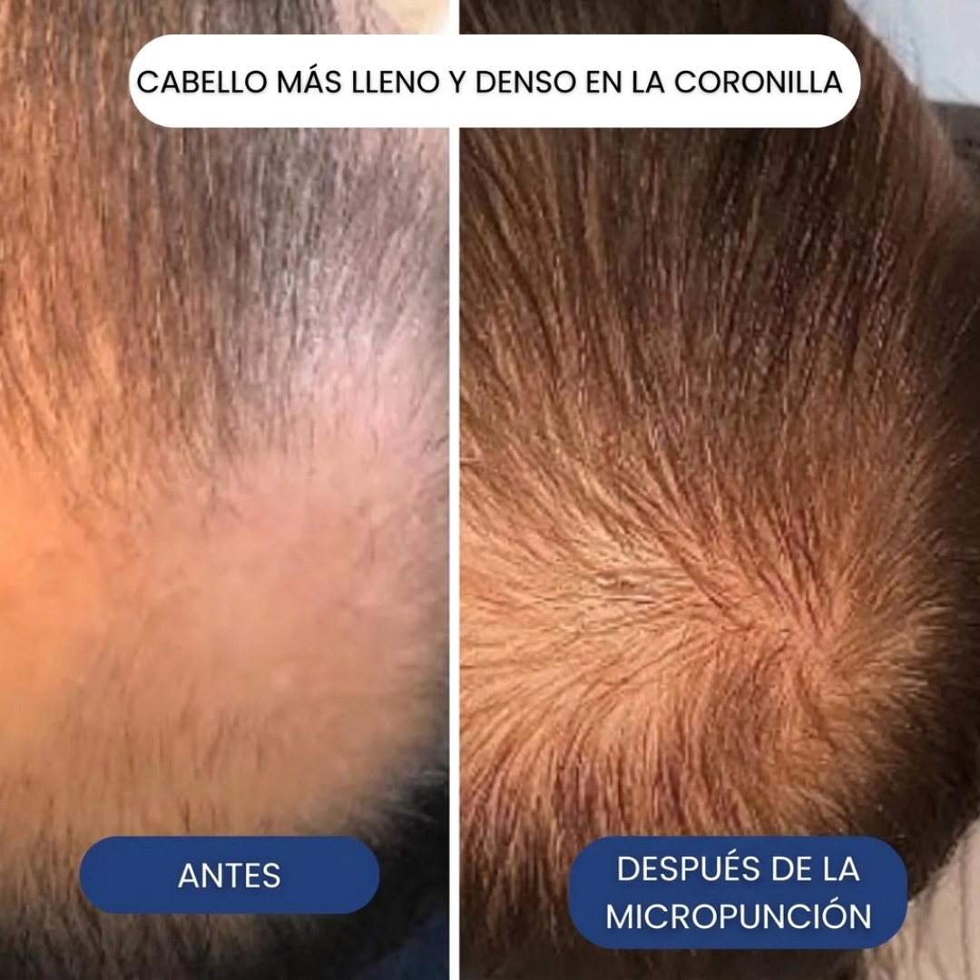 Tratamiento de infusión para crecimiento del cabello de Biocenti