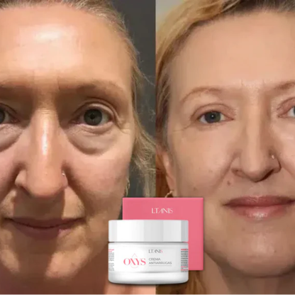 OXYS® Crema Antiarrugas con Efecto Lifting Inmediato - Día y Noche