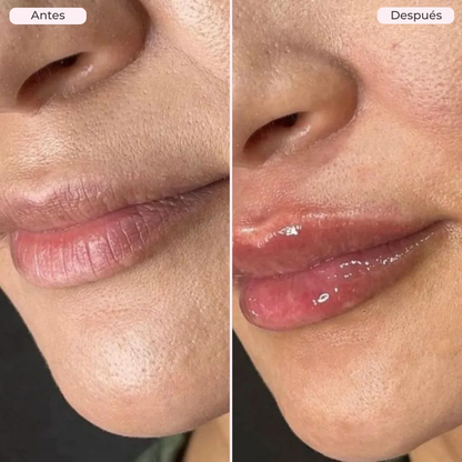 Sérum Voluminizador de Labios de Biocenti