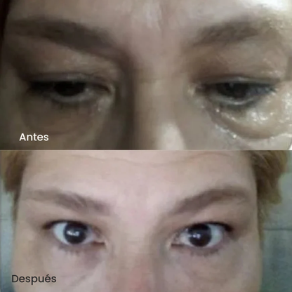 Roller Anti-Ojeras con Ácido Hialurónico