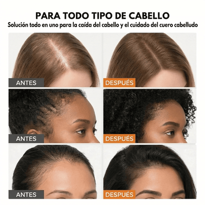 El sérum para el crecimiento del cabello N° 1 de Corea