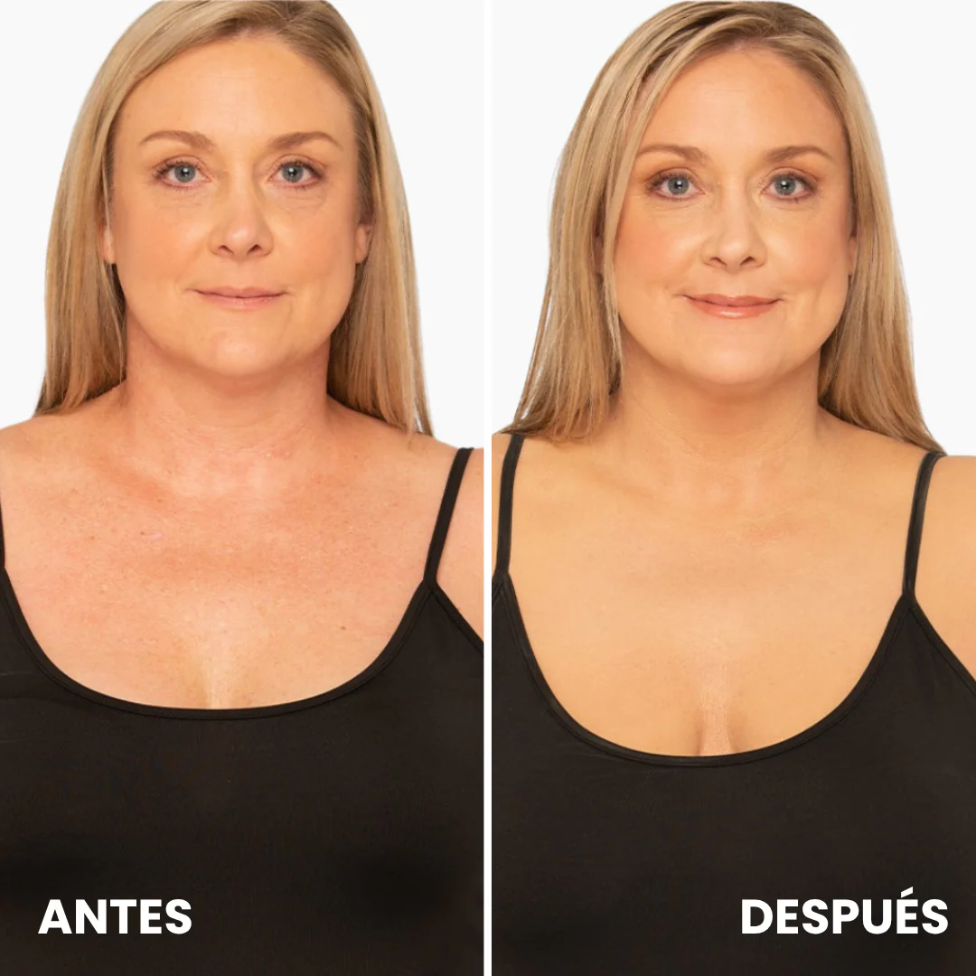 Biocenti Corrector Corporal