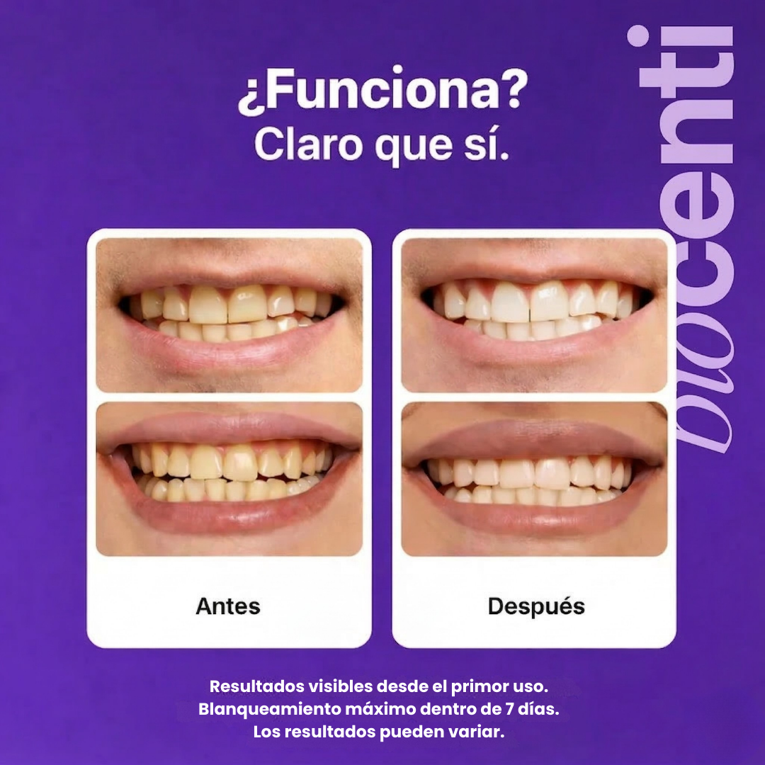 Tiras Blanqueadoras Dentales de Biocenti