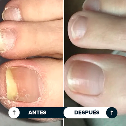 Biocenti | Lápiz Antihongos